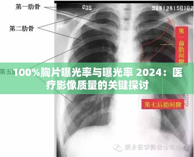 100%胸片曝光率与曝光率 2024：医疗影像质量的关键探讨