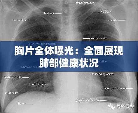 胸片全体曝光：全面展现肺部健康状况