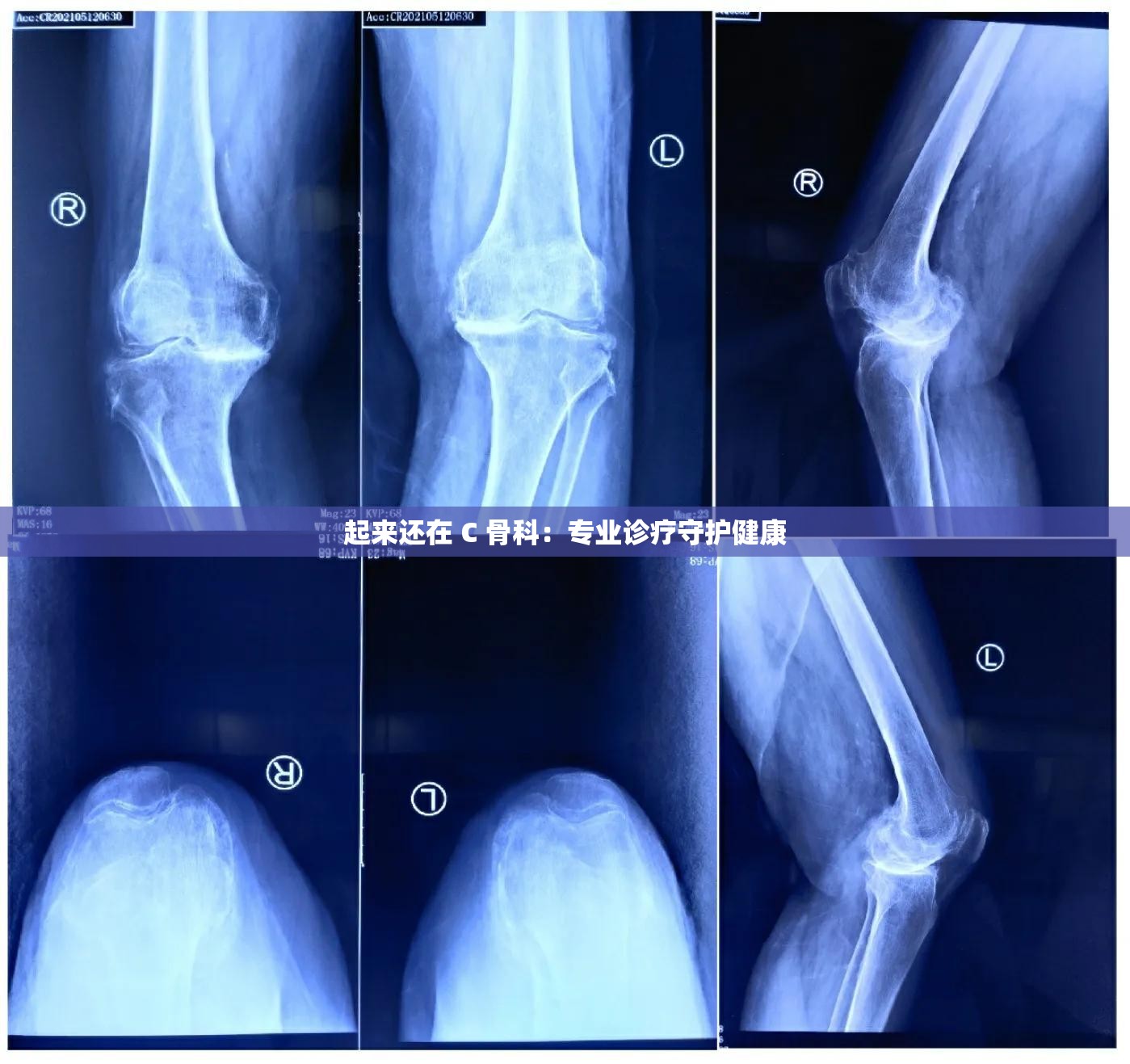 起来还在 C 骨科：专业诊疗守护健康