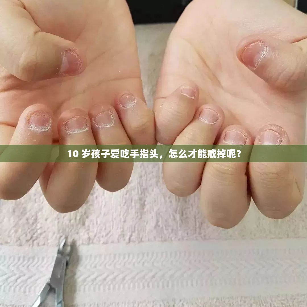 10 岁孩子爱吃手指头，怎么才能戒掉呢？